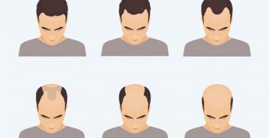 Top Hair Loss courses of the year